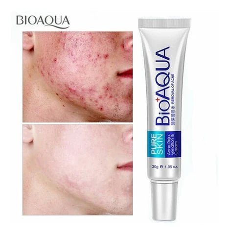 CREMA ANTIACNE ESPINILLA BIOAQUA