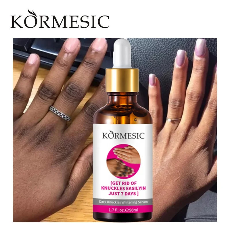 SERUM BLANQUEADOR DE NUDILLOS KORMESIC